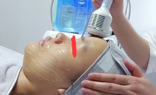 美容院冷热锤操作注意事项